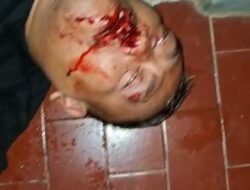 Paru Paru Bocor Diduga Akibat Hantaman Linggis bertubi tubi, Kondisi Memprihatinkan Sholeh Korban dugaan Pengroyokan Di Parkiran Benang Raja Salatiga, Polresta Salatiga Belum Menangkap Pelaku
